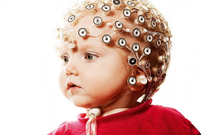 أعراض كهرباء المخ عند الأطفال