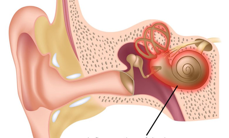 اعراض التهاب الاذن الداخلية والصداع