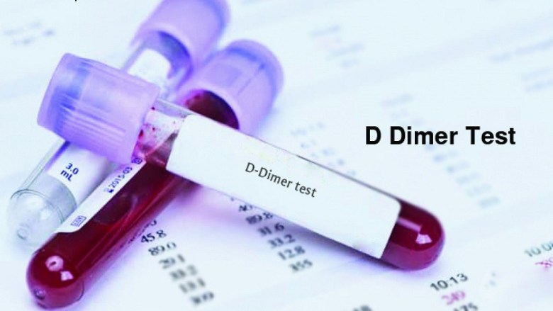 نسبة تحليل d-dimer الطبيعي