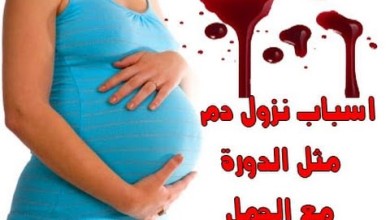 نزول دم اثناء الحمل