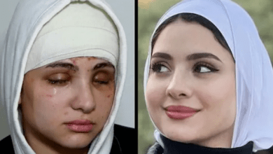 أصيبت بالعمى وخطيبها تركها.. تفاصيل الحالة الصحية للبلوجر سارة محمد-فيديو