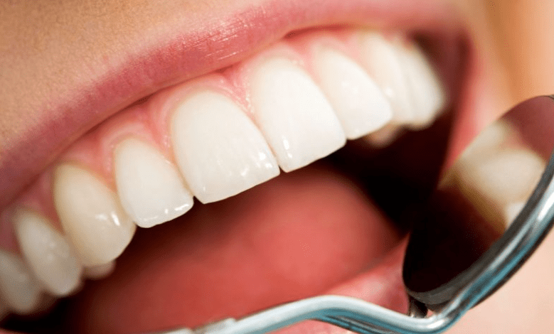 العناية بالأسنان خلال شهر رمضان