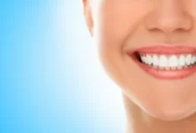 Die besten Möglichkeiten zur Erhaltung der Zahngesundheit